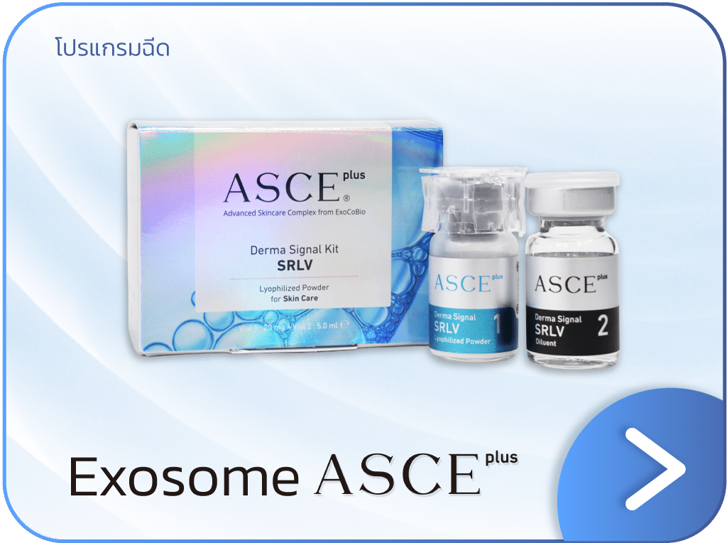 ASCE (Exosome) คือ