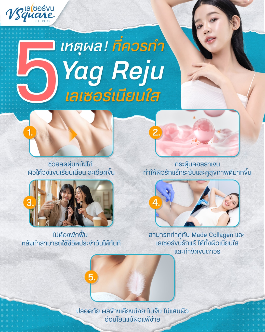 Yag Reju เลเซอร์เนียนใส ข้อดี