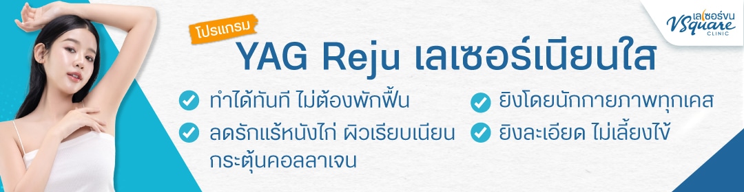 Yag Reju เลเซอร์เนียนใส