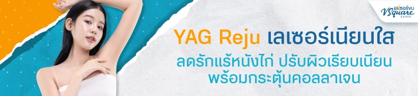 Yag Reju