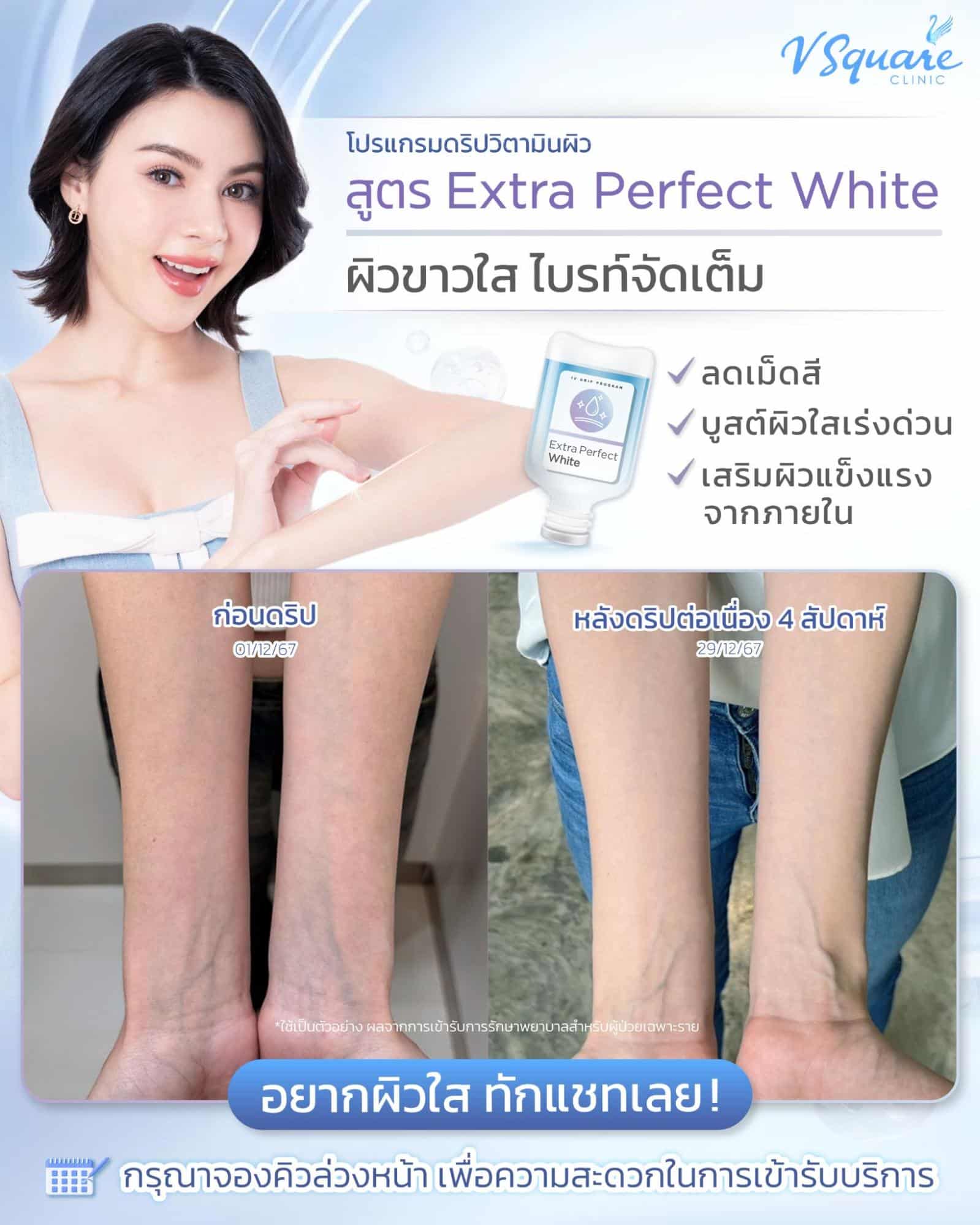 รีวิวดริปวิตามินแก้ผิวขาดน้ำ