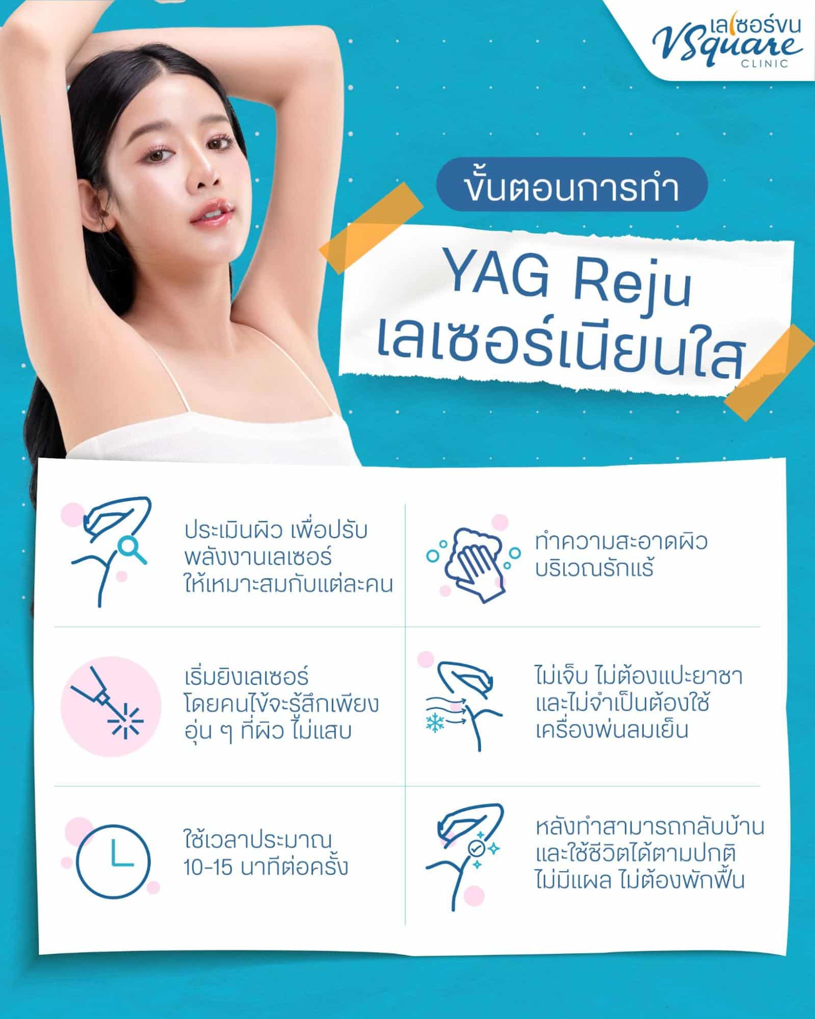 ขั้นตอนการทำ Yag Reju เลเซอร์เนียนใส