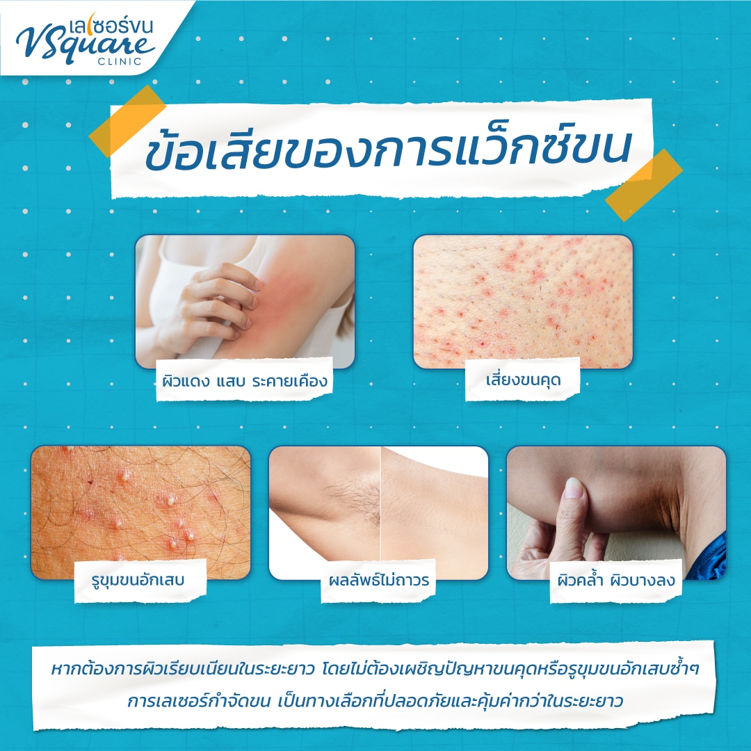 ข้อเสียของการแว็กขน