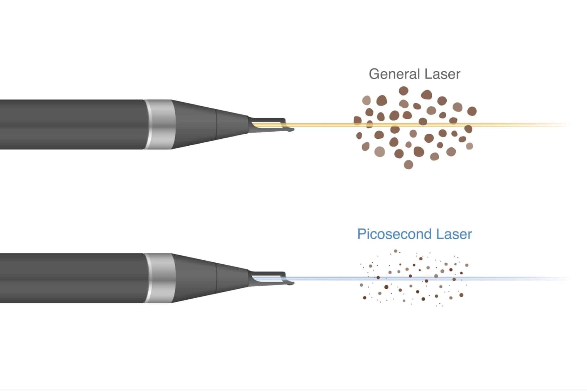 พิโค่เลเซอร์