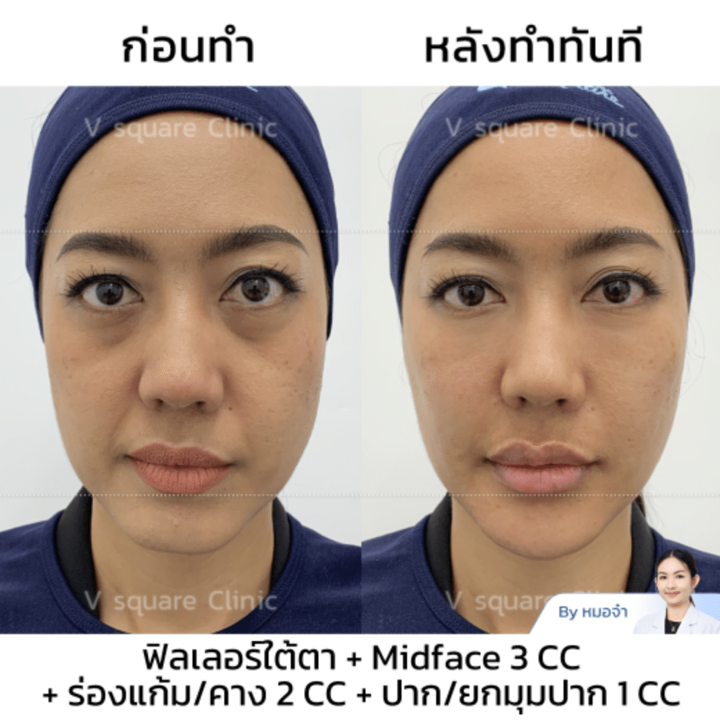 รีวิวยกมุมปาก_คุณหงส์