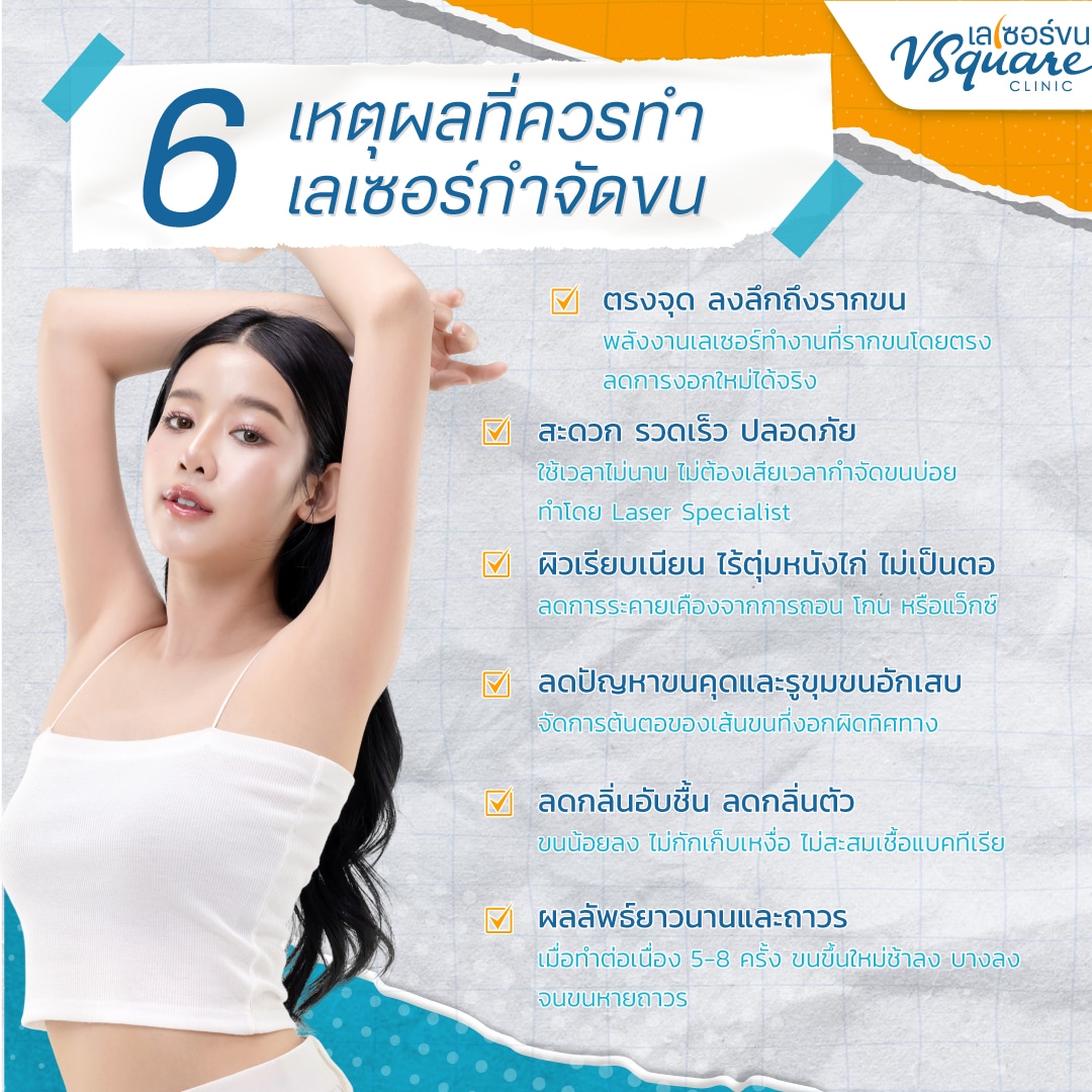 เลเซอร์กำจัดขนดีอย่างไร