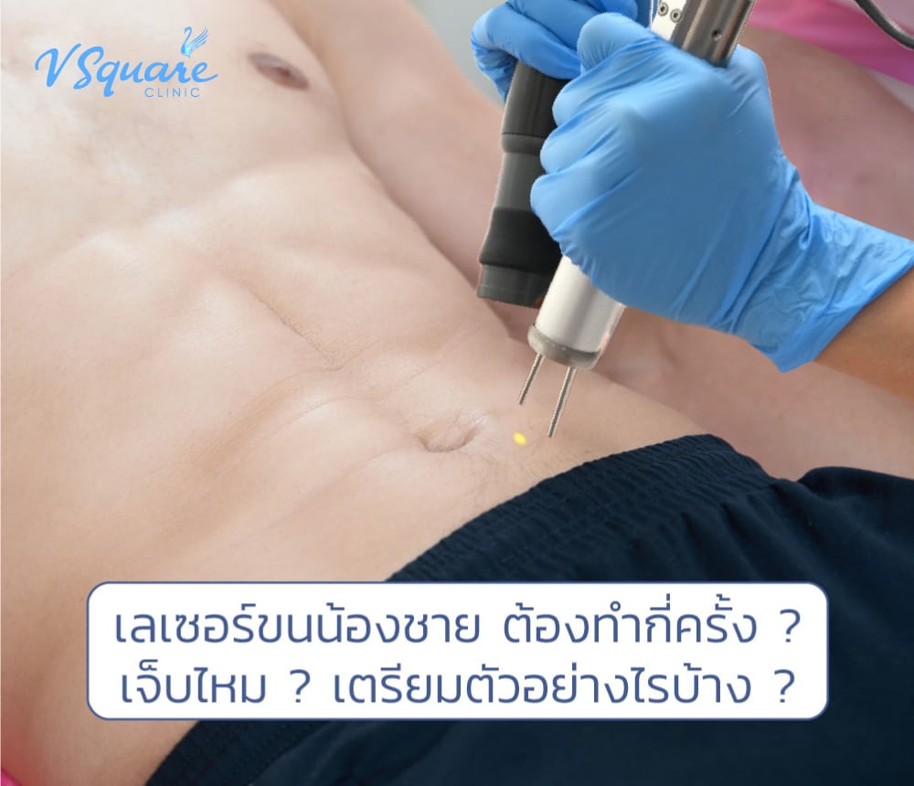 เลเซอร์ขนน้องชาย