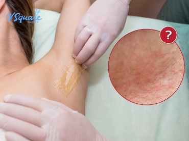 แว็กซ์ขน 370x277