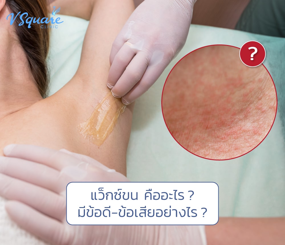 แว็กซ์ขน