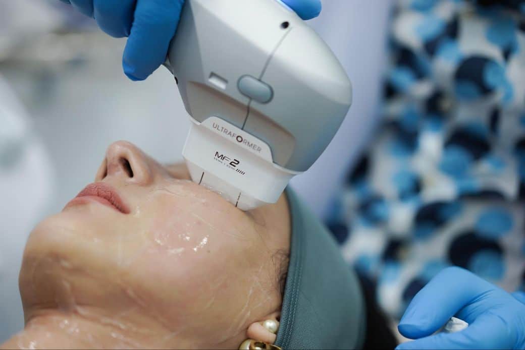 Hifu Ultraformer ลดถุงใต้ตา