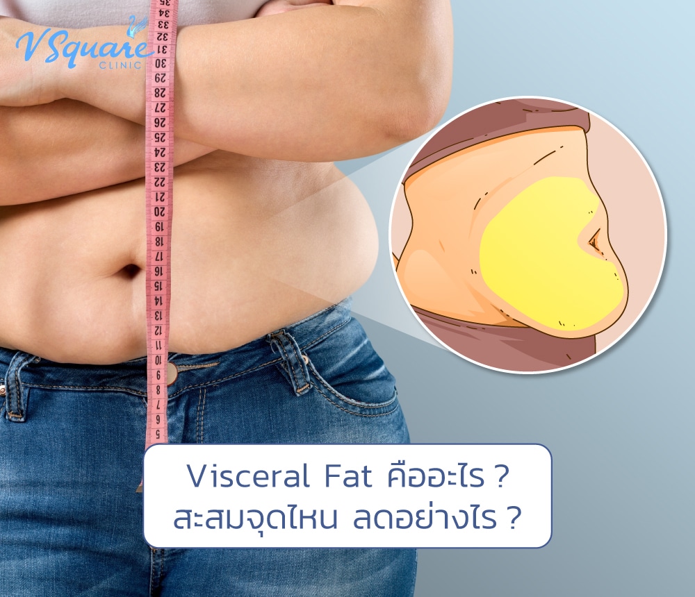 Visceral Fat คือ
