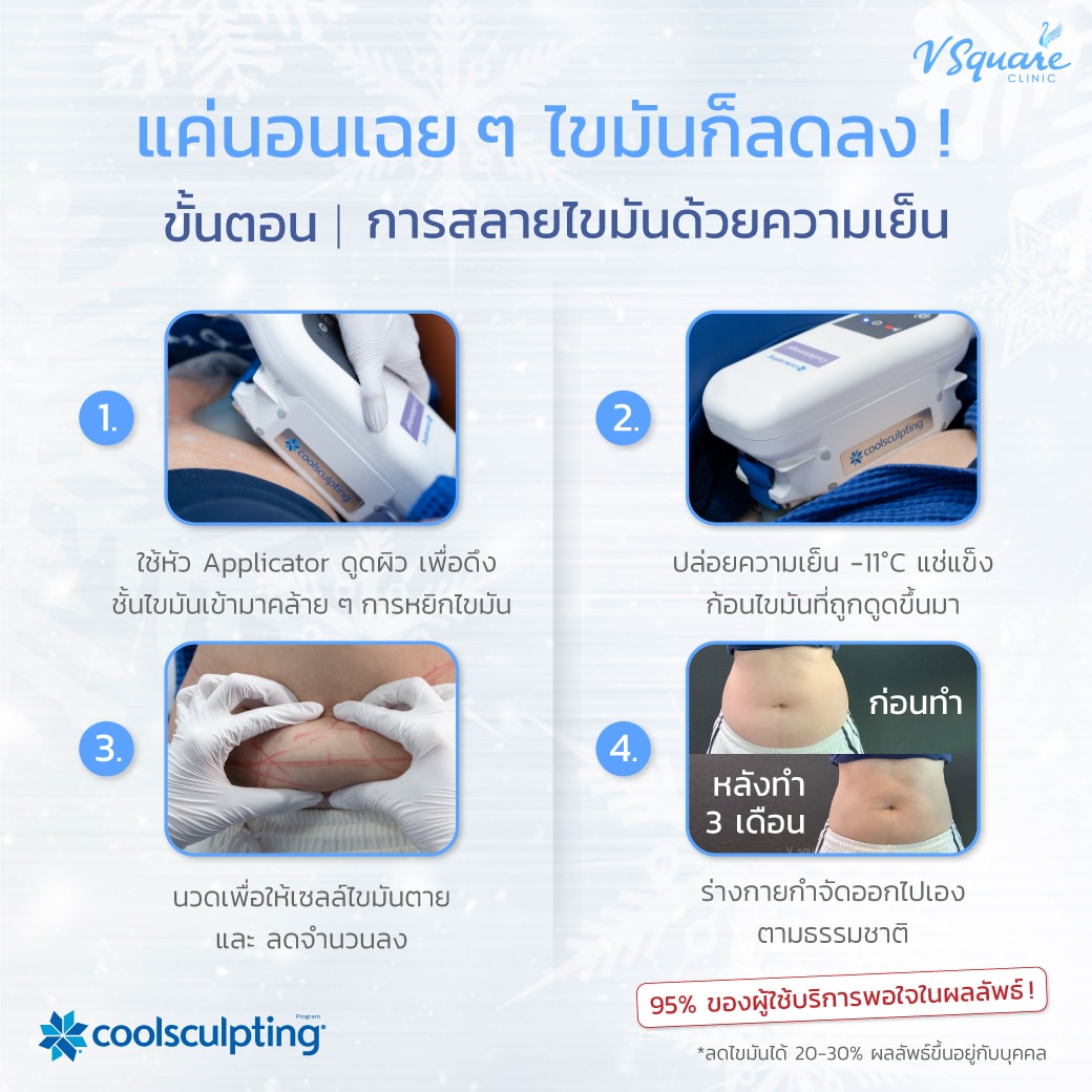 ขั้นตอนการสลายไขมันด้วยความเย็น