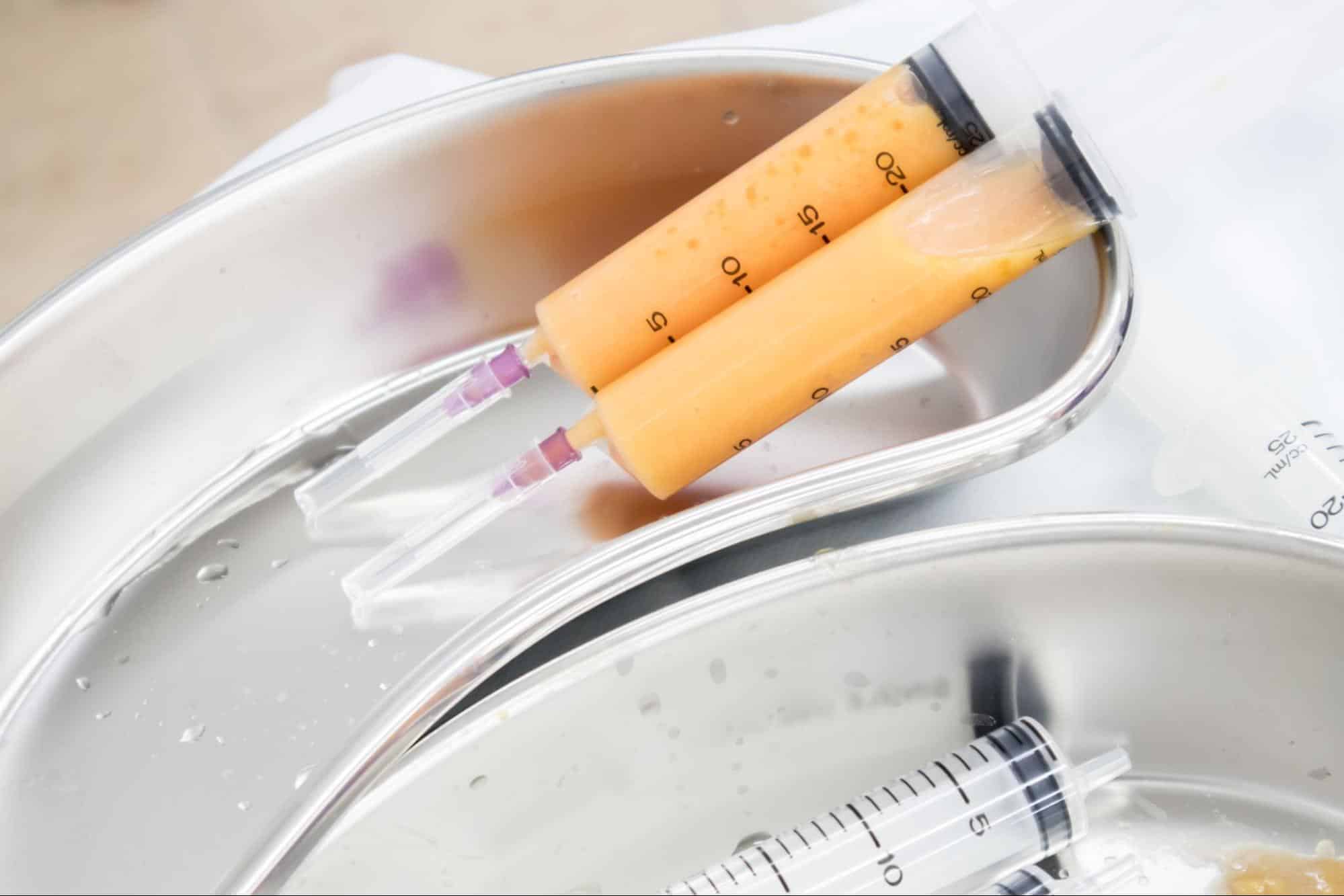 ดูดไขมันกรอบหน้าเหลี่ยม