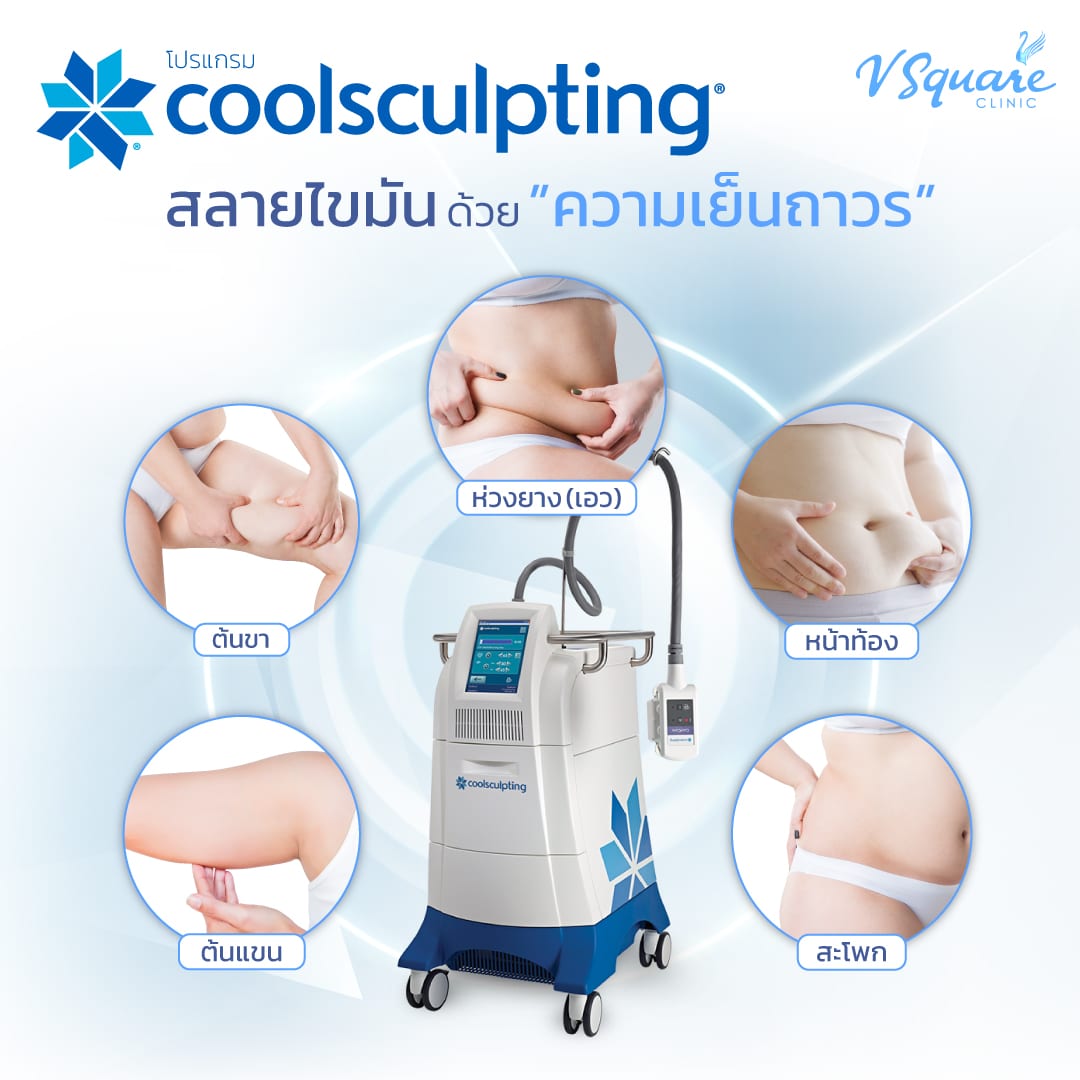 ตำแหน่งทำ CoolSculpting สลายไขมันด้วยความเย็น