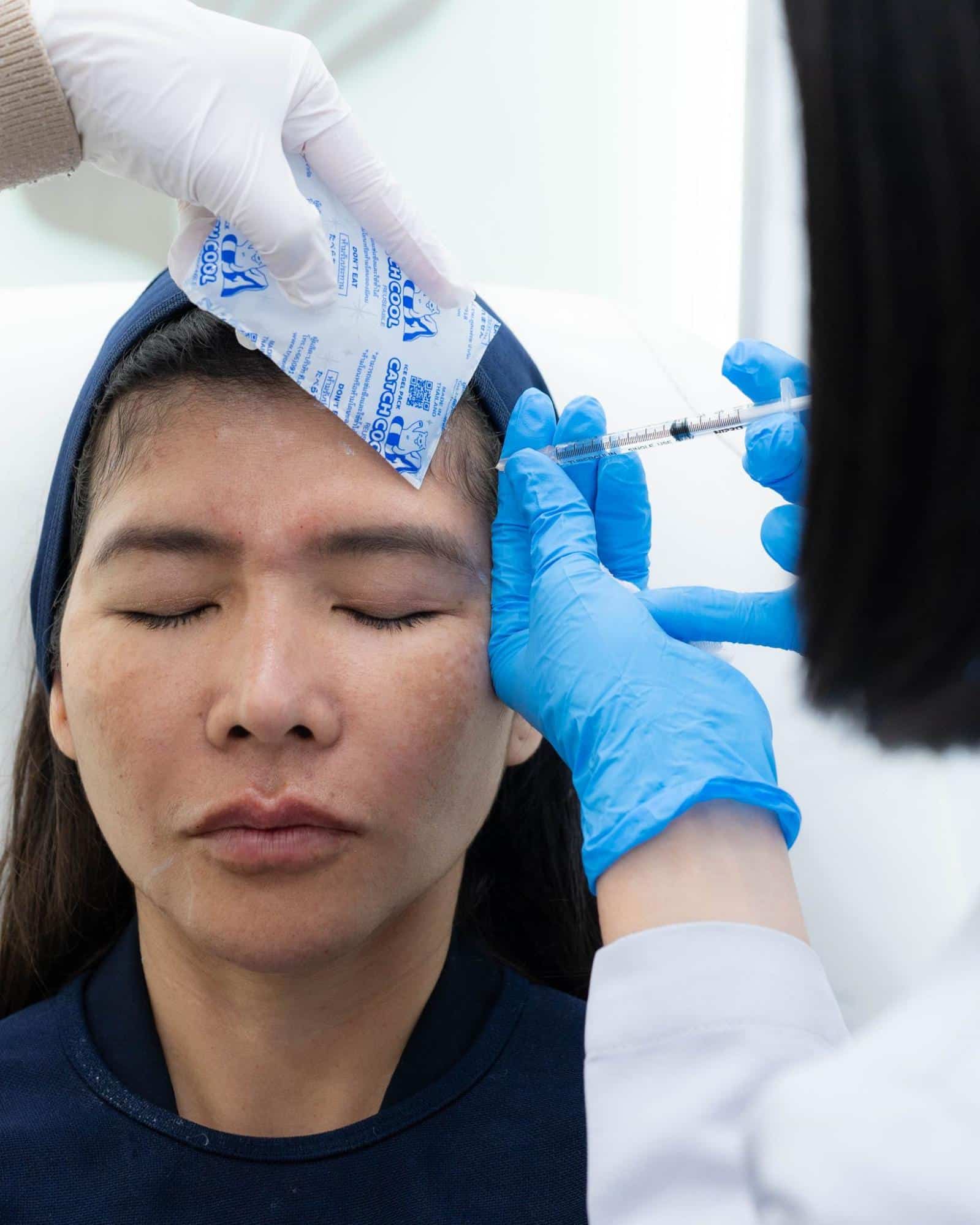 ประคบน้ำแข็งก่อนฉีด INBO Botox