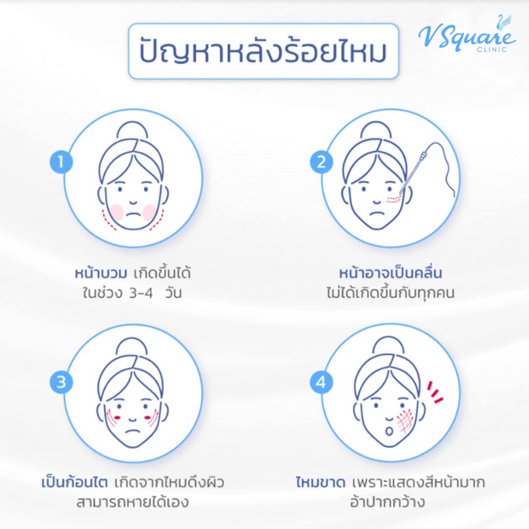 ปัญหาหลังร้อยไหม