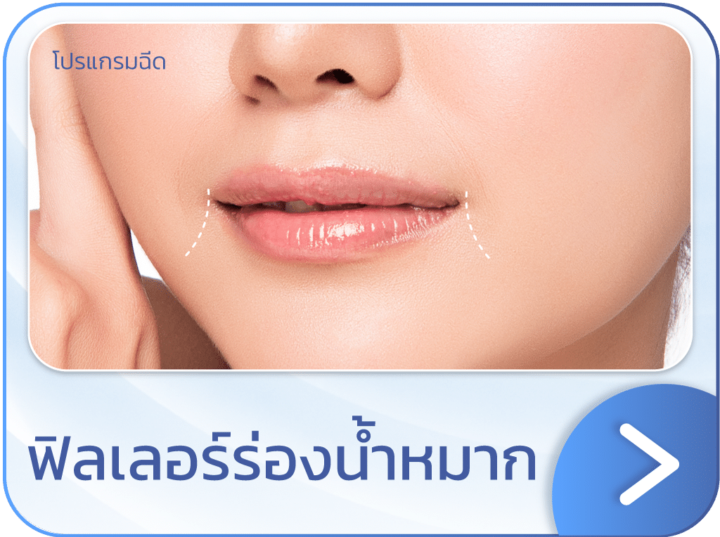 ฟิลเลอร์ร่องน้ำหมาก