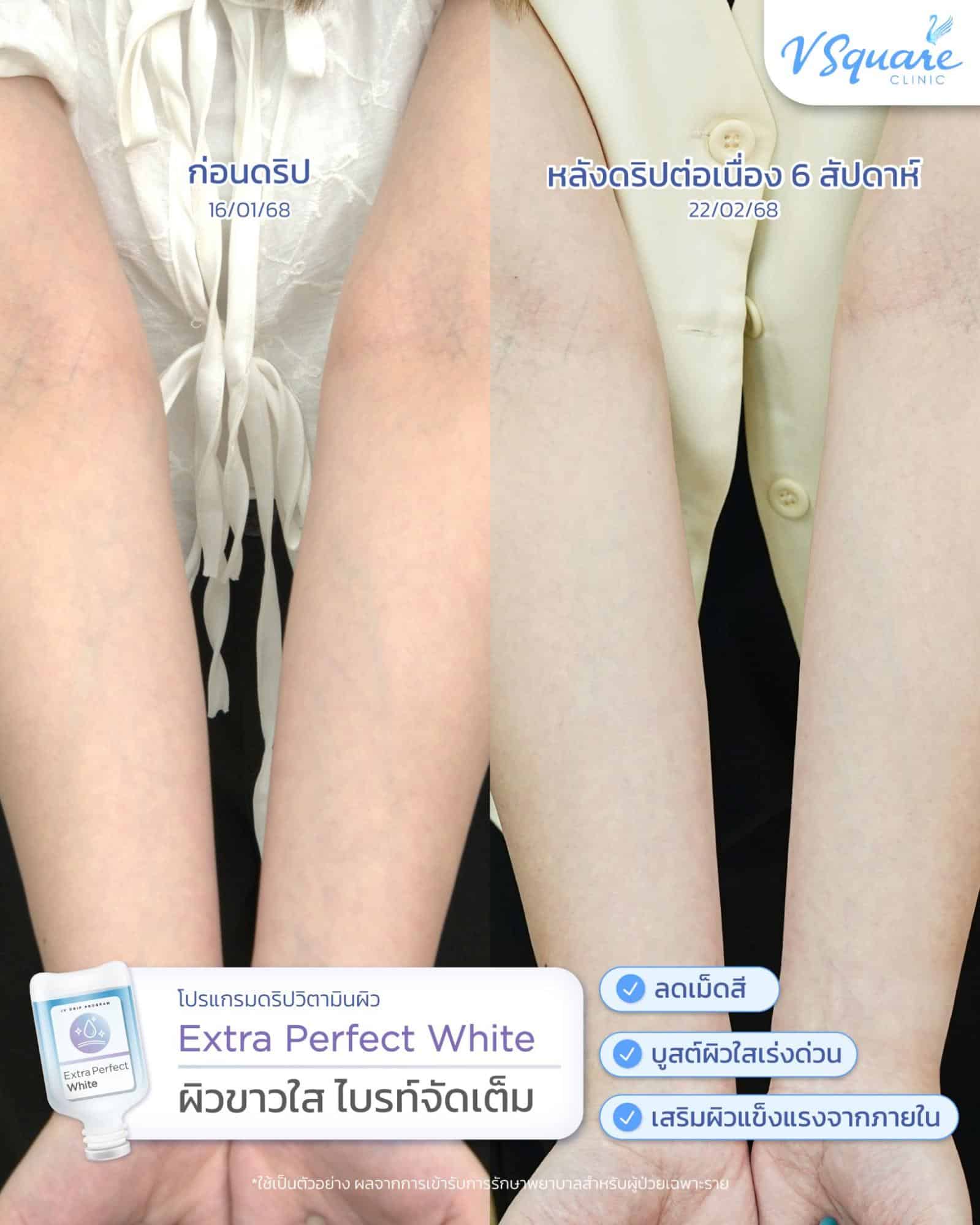 รีวิวดริปวิตามินผิว