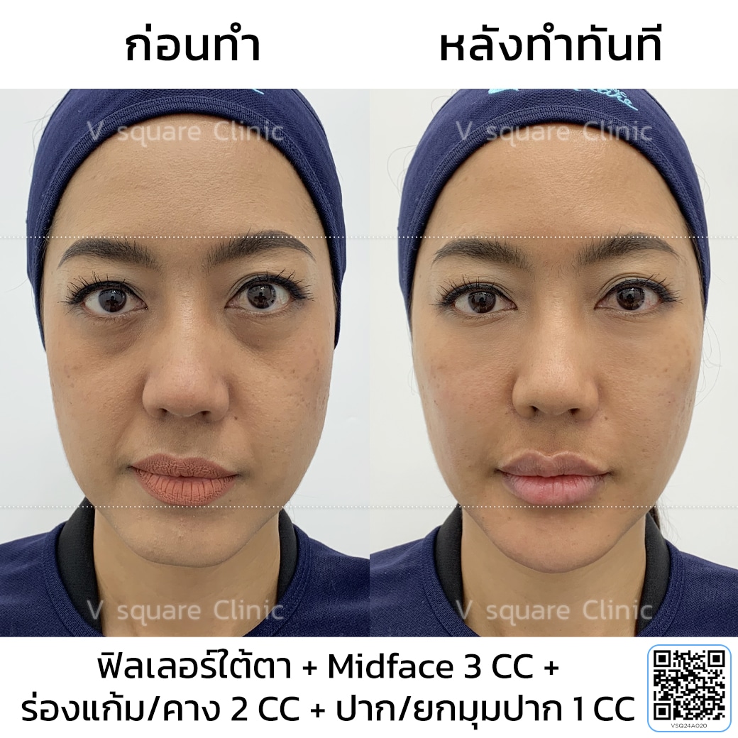 รีวิวยกมุมปาก_คุณหงส์