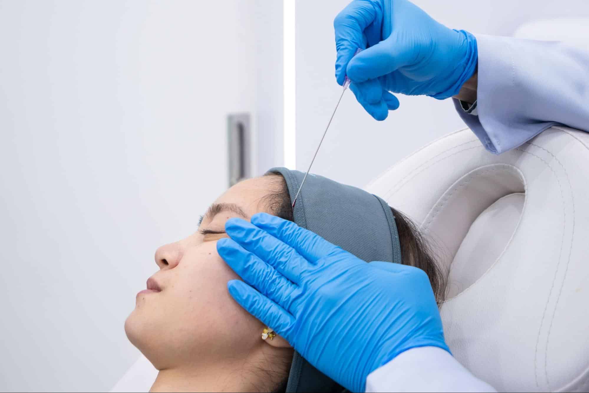 ร้อยไหม PDO คืออะไร