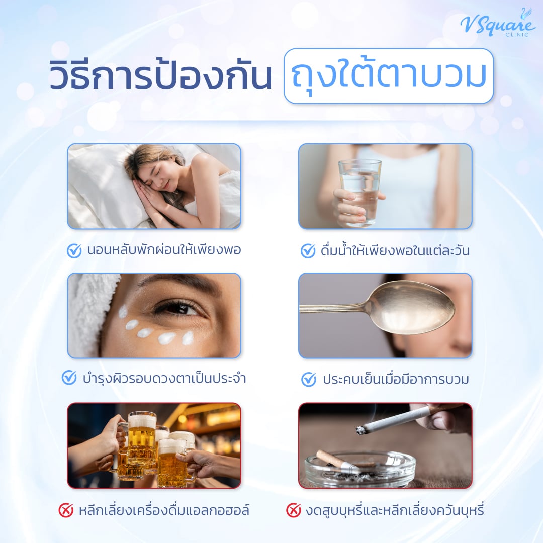 วิธีป้องกันถุงใต้ตาบวม