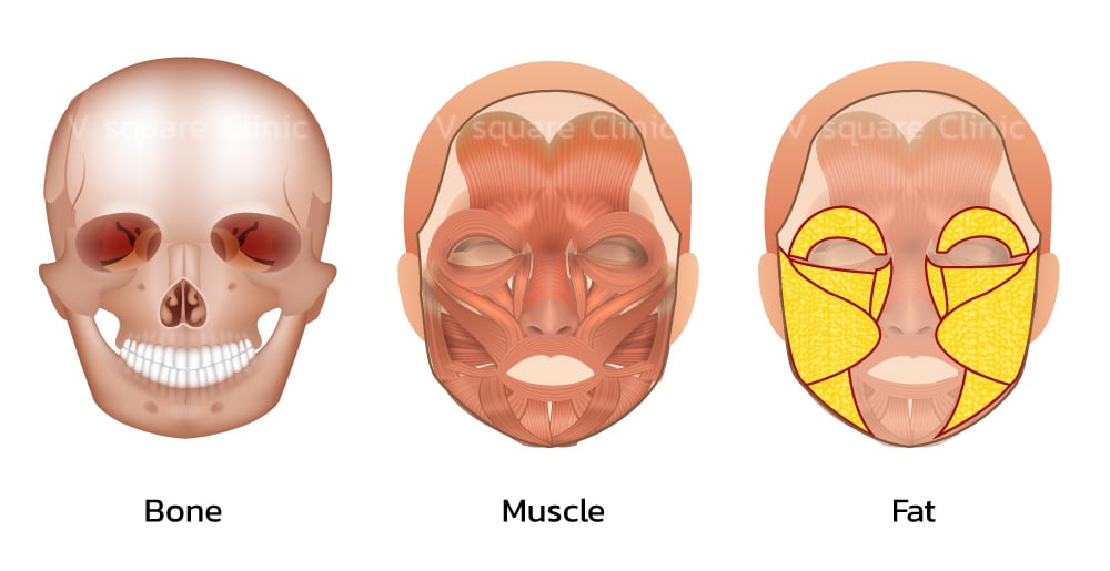 สาเหตุหน้าเหลี่ยม