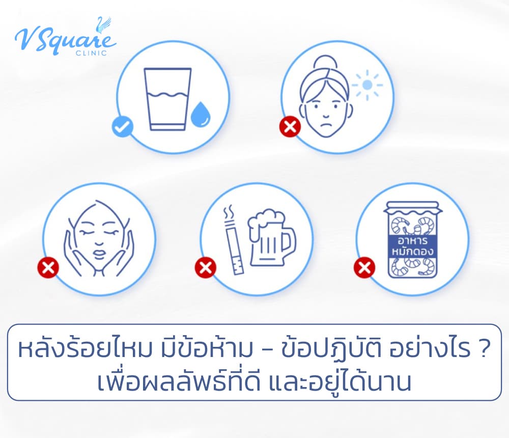 หลังร้อยไหม