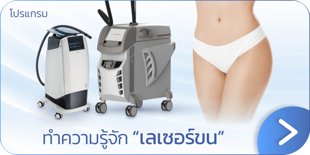 เลเซอร์ขน คืออะไร