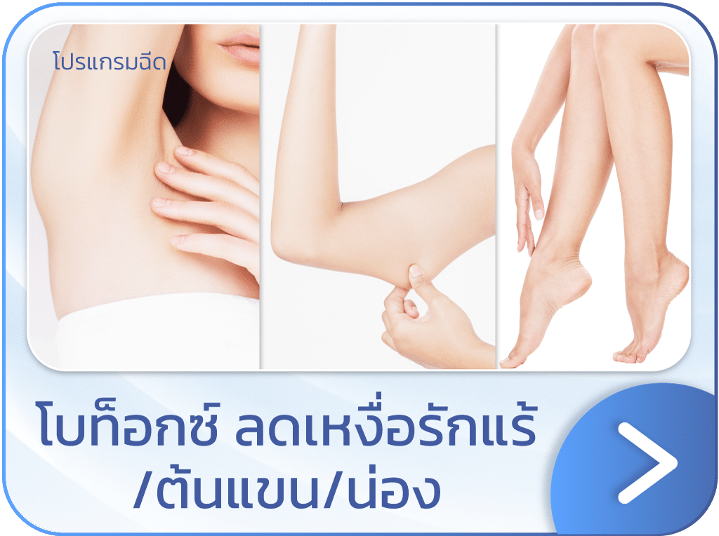 โบท็อกลดเหงื่อ