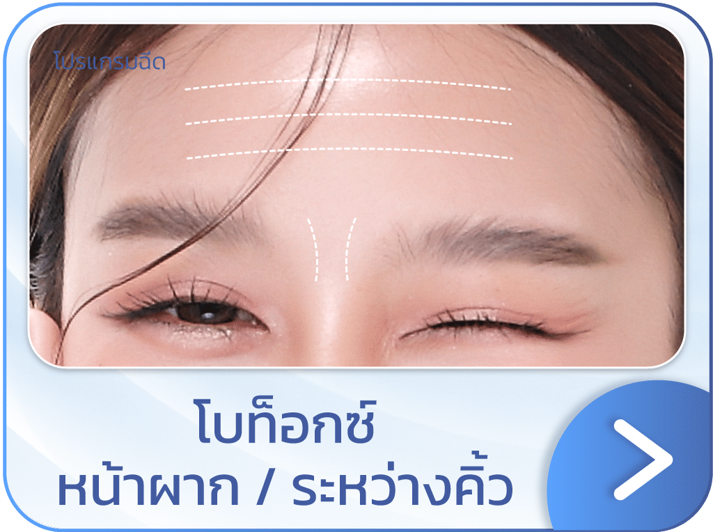 โบท็อกหน้าผาก