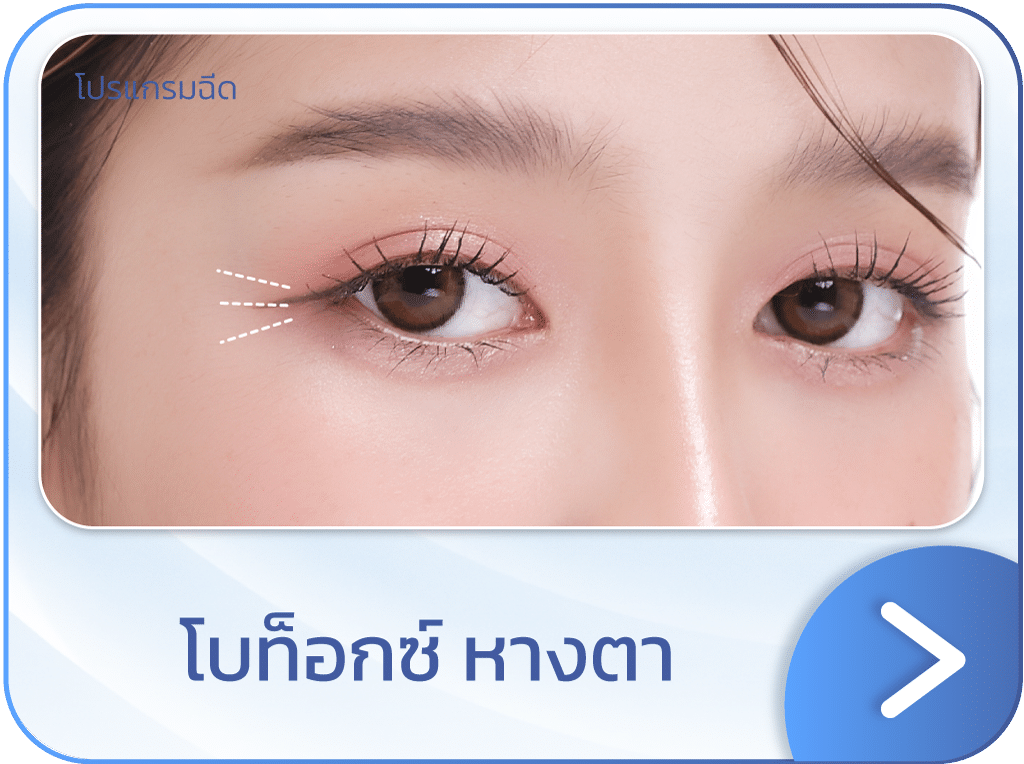 โบท็อกหางตา