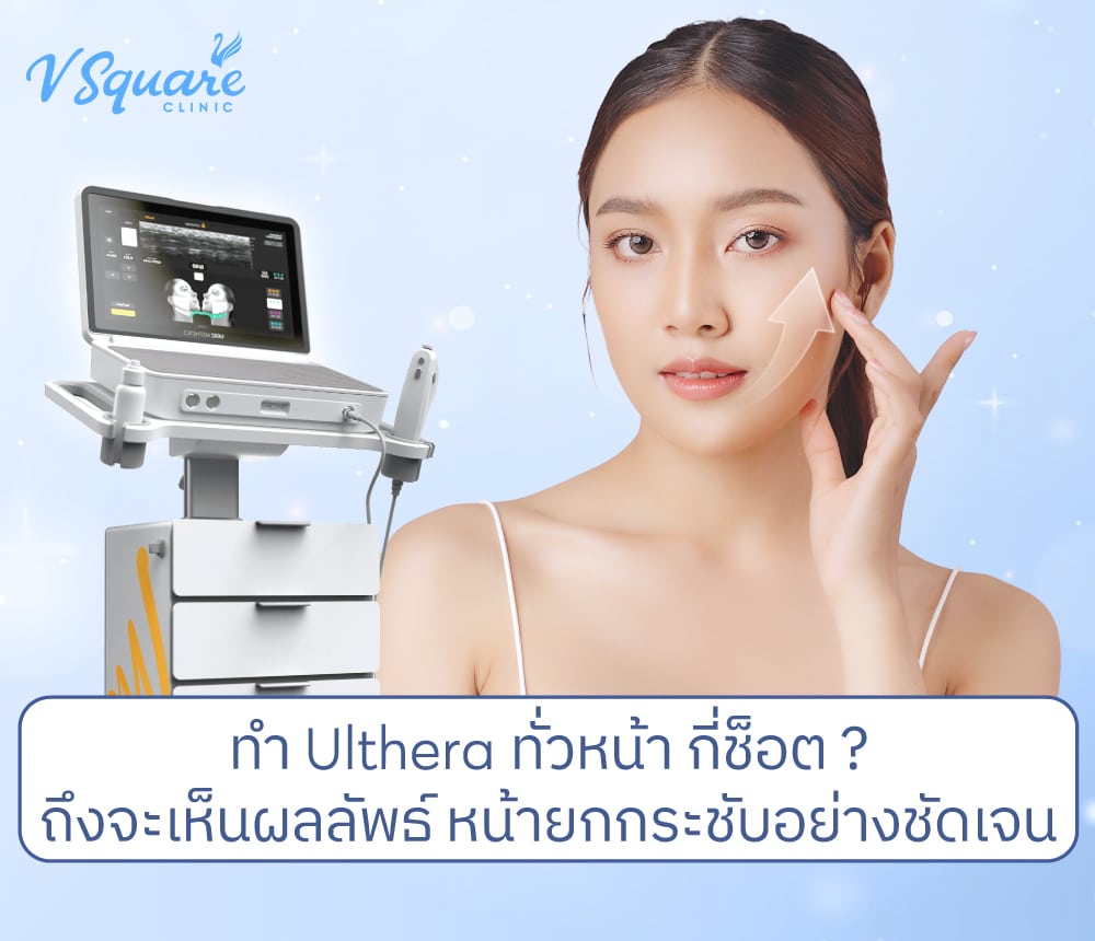 Ulthera Ruler ทำ Ulthera ทั่วหน้า กี่ช็อต/ไลน์ ถึงจะเห็นผล? ยกกระชับชัดเจน