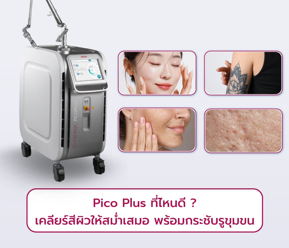 Pico-Plus-ที่ไหนดี