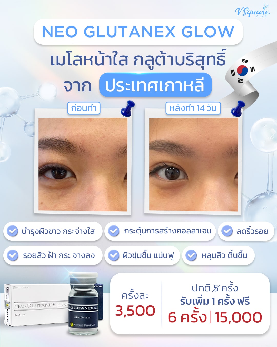 รีวิว Neo Glutanex Glow ก่อน-หลังฉีด