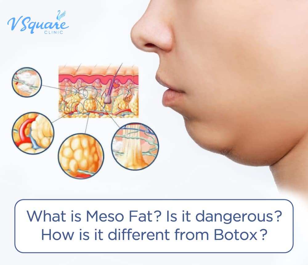lipo c injection dosage chart for weight loss reddit Bioboost/Lipotropic Injections : r/tirzepatidecompound