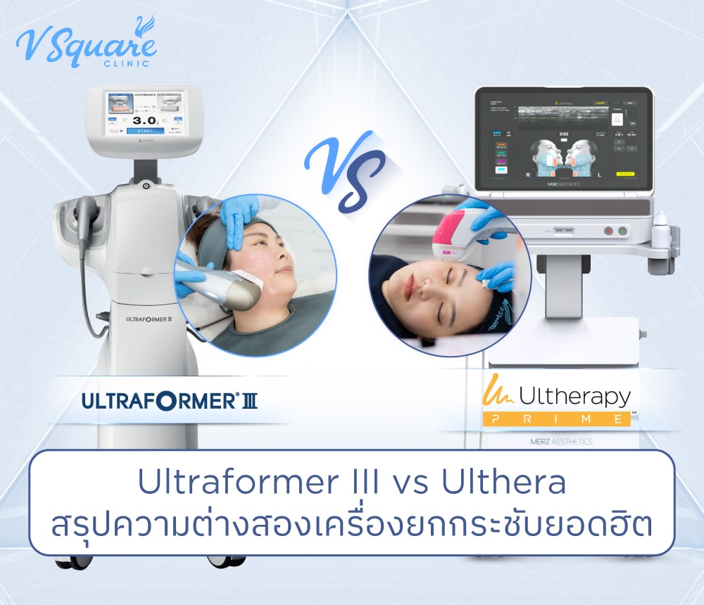 Ulthera Ruler Ultraformer III vs Ulthera ต่างกันอย่างไร เทียบราคา ผลลัพธ์