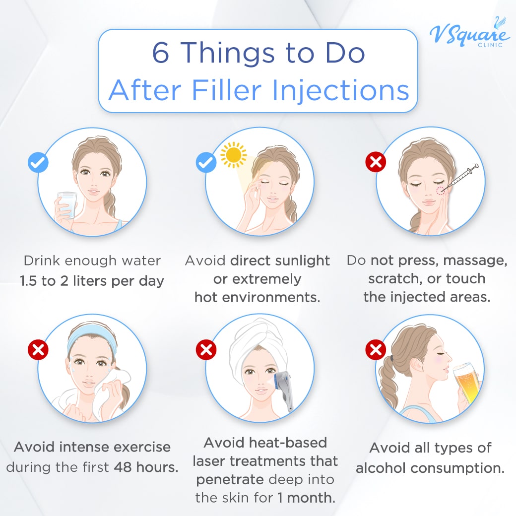 Fc Max Injection Flore Max Filler: Injection Areas & How It Compares