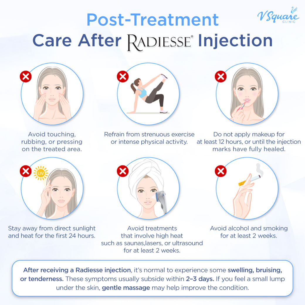 Post-treatment care after Radiesse Plus