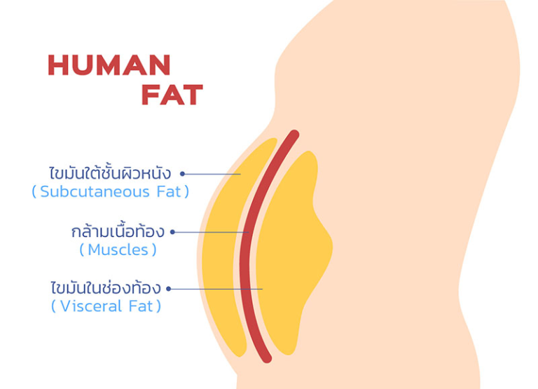 Chelev Fat Belly Fat Reduction: Fast, Non-Invasive Ways That Work