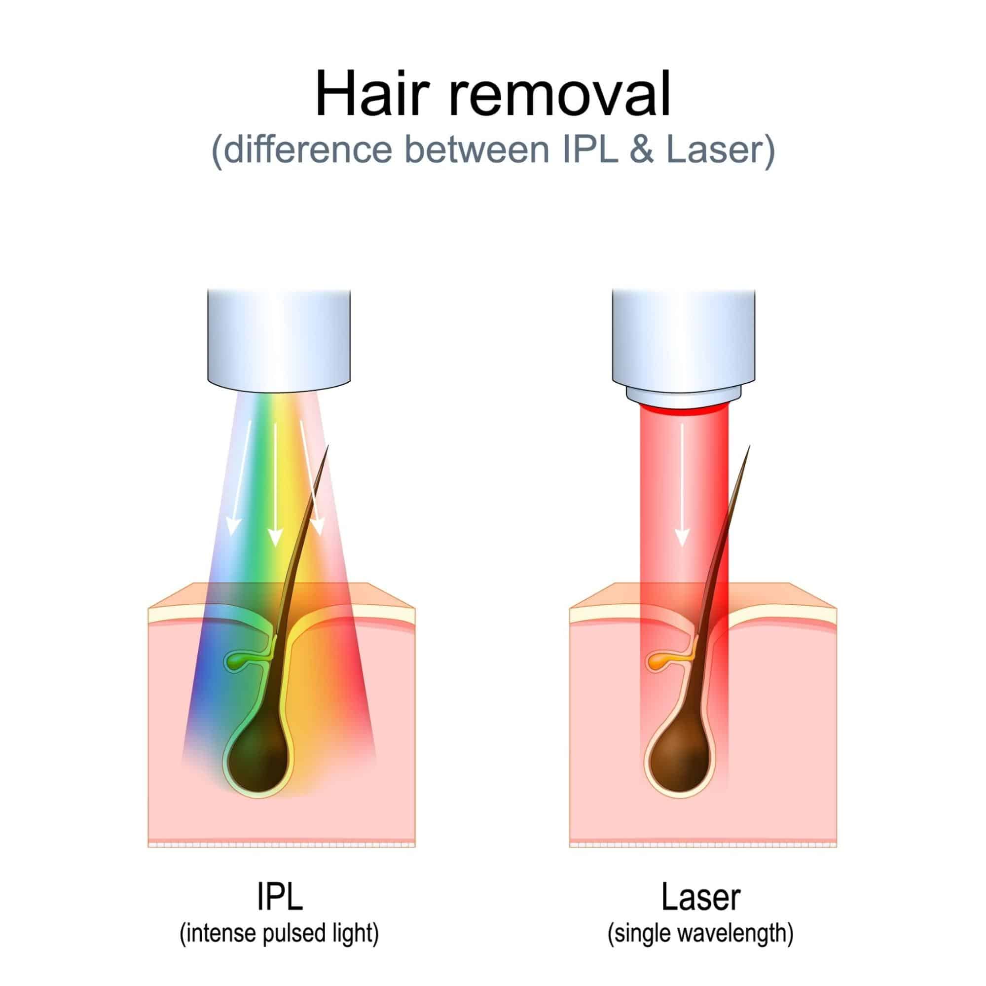 13 Hair Removal Methods: Which One Is Best & Is DIY Safe