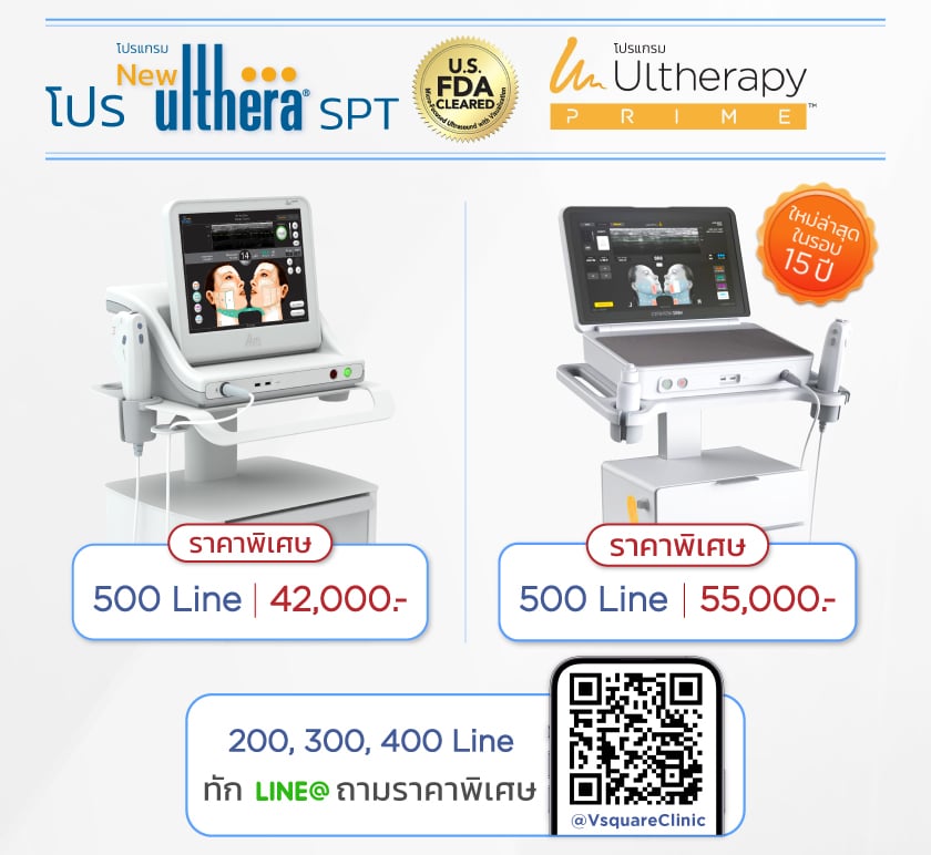 Ulthera Ruler ราคา Ulthera 300 Shot เท่าไหร่ ? ยกแก้ม ลดเหนียง เห็นผลไหม