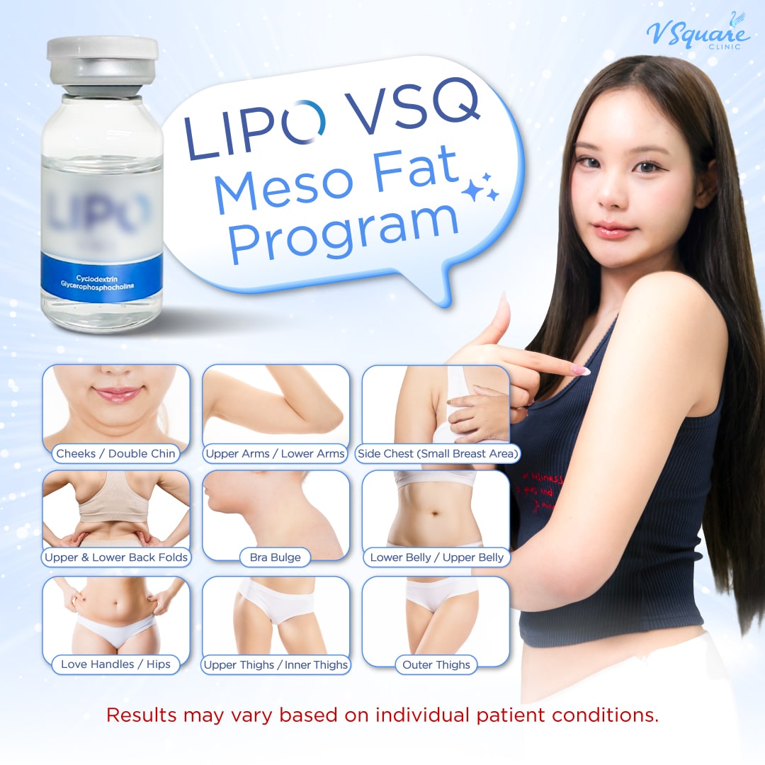 Belly Fat Reduction: Fast, Non-Invasive Ways That Work