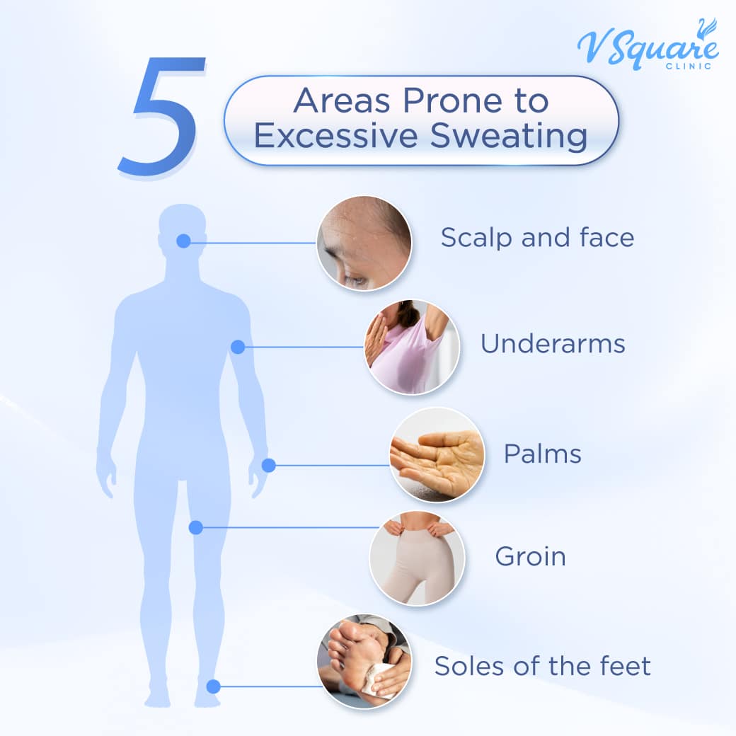 Excessive Sweating Problem Excessive Sweating — Causes, Treatment, and Odor Control