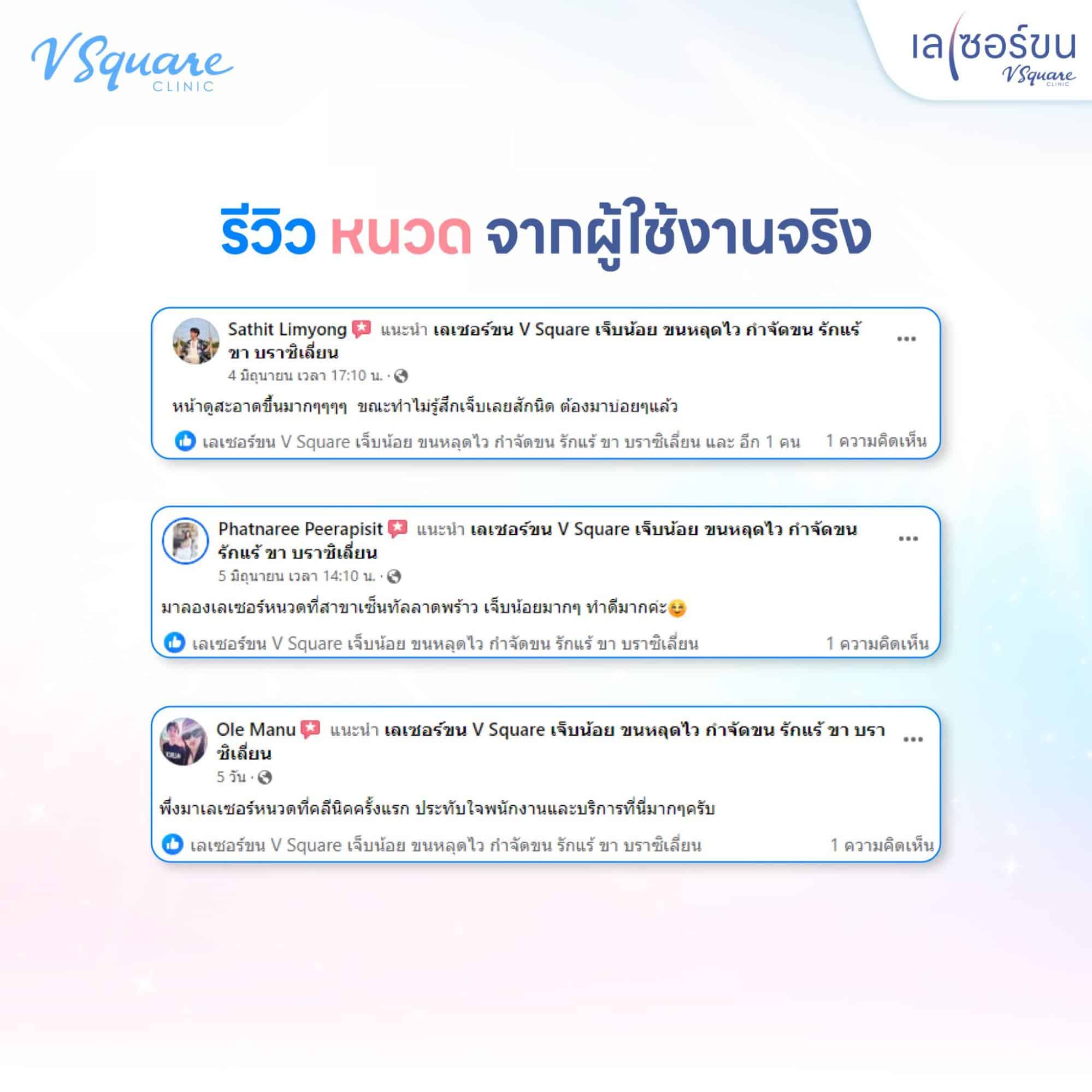 เลเซอร์หนวด รีวิว