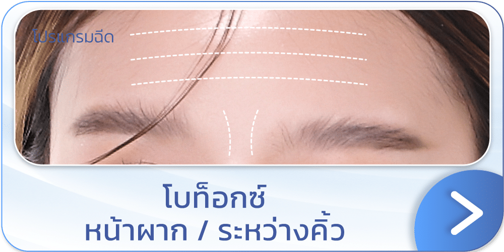 โบท็อกขมวดคิ้ว