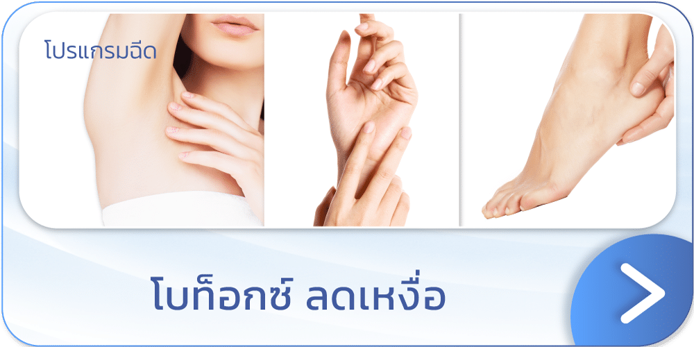 โบท็อกลดเหงื่อ