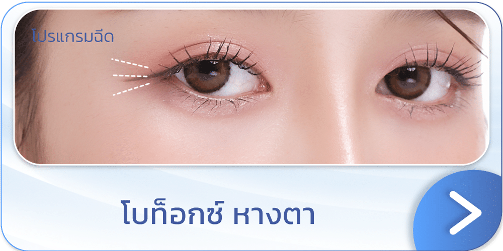 โบท็อกหางตา