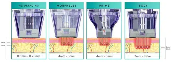 Morpheus8 หลักการทำงาน