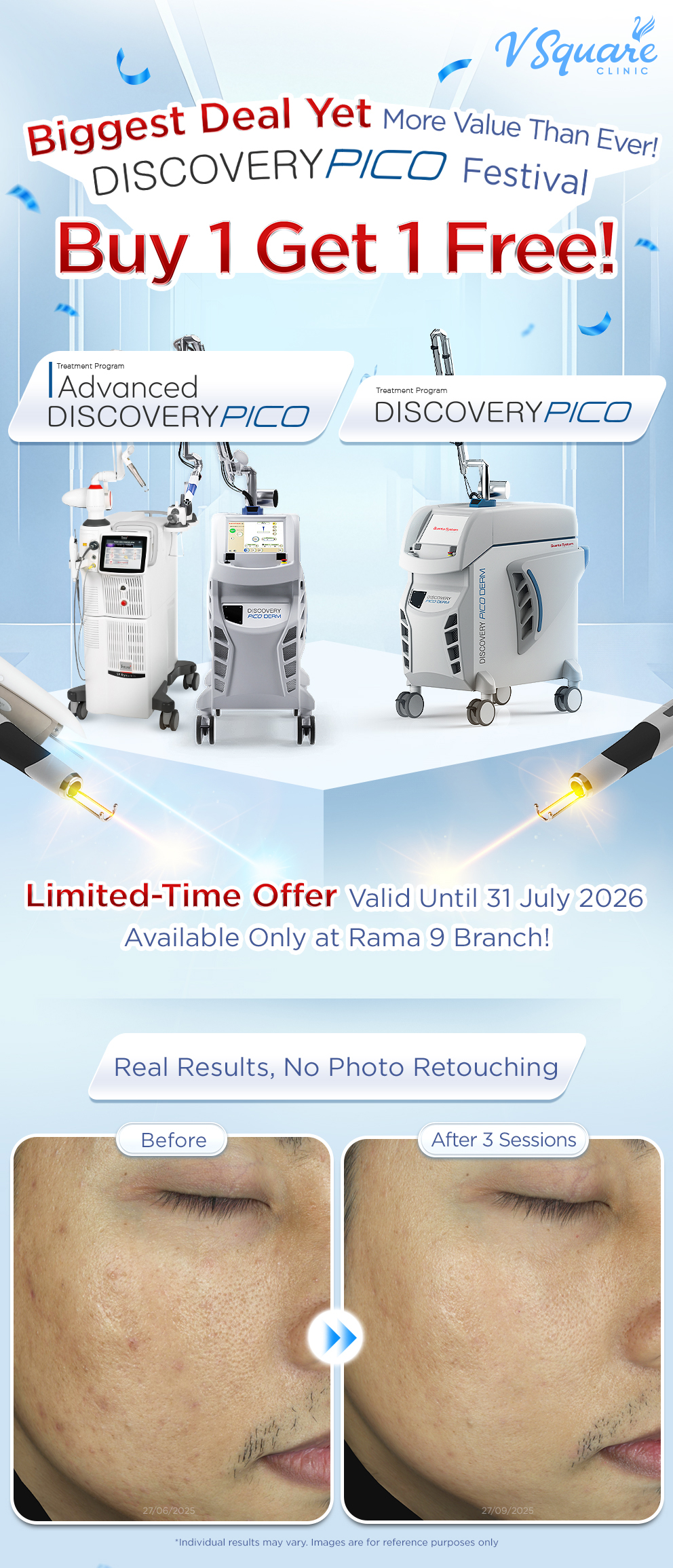 Pico Buy 1 Get 1 Free