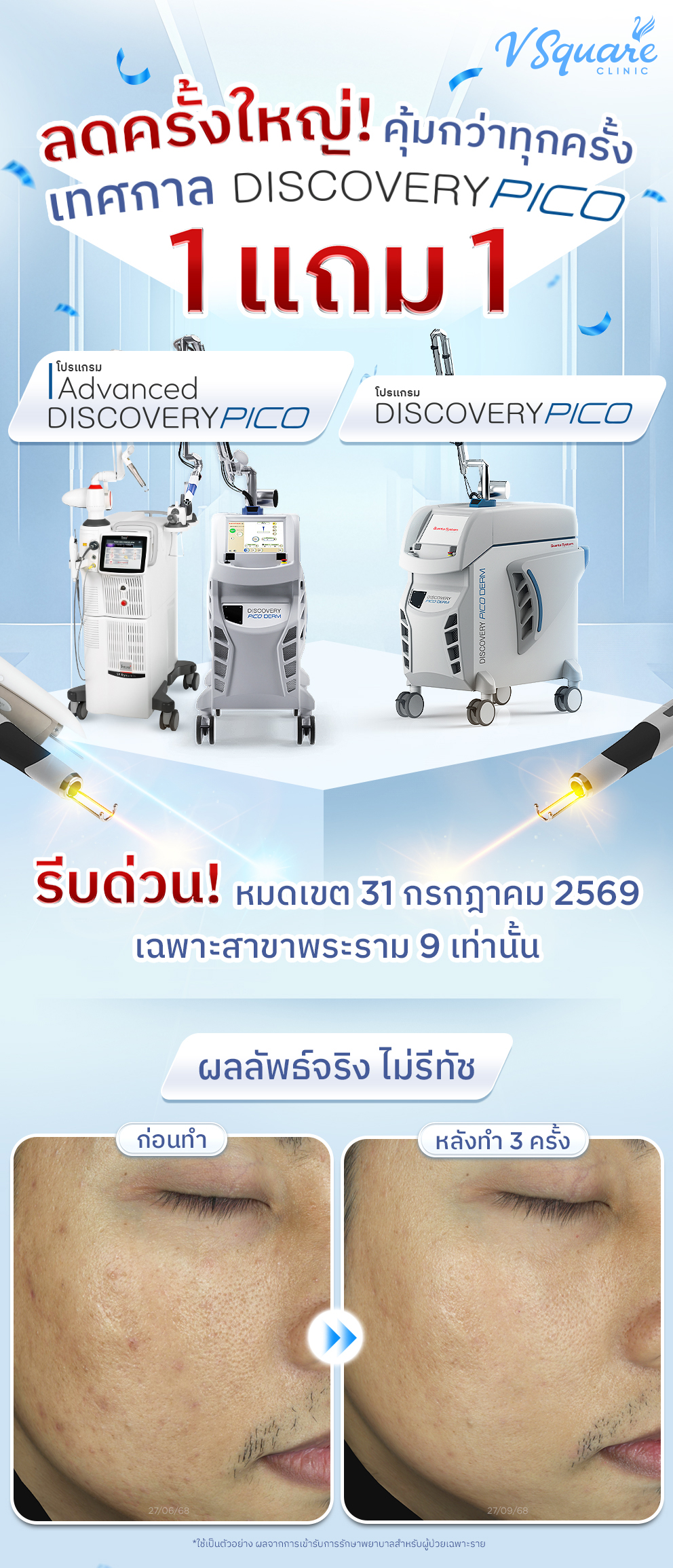 ลดครั้งใหญ่! คุ้มกว่าทุกครั้ง เทศกาล DISCOVERY PICO 1 แถม 1